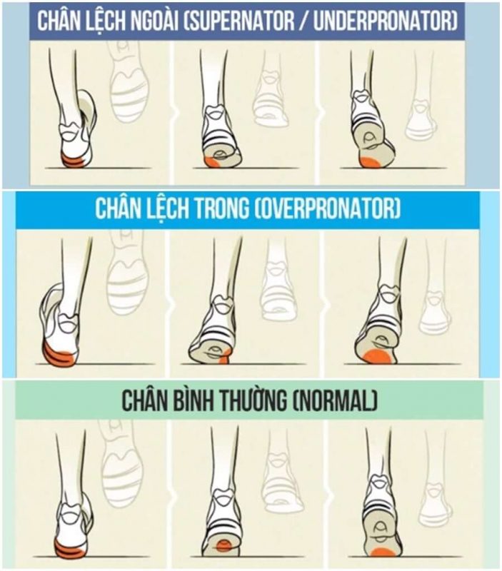 Cách chọn giày chạy bộ